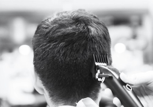 Male Grooming: How to Maintain a Healthy Scalp and Prevent Dandruff